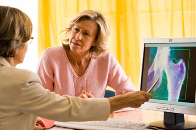Según especialista, para 2025 más de 3 millones de chilenas padecerían Osteoporosis
