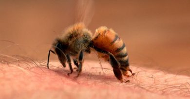 ¿Qué hacer ante picaduras de arañas, abejas y avispas?
