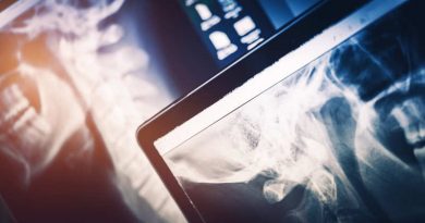 La importancia de la imagenología en diagnósticos oportunos