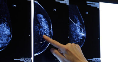 Hospital Dr. Gustavo Fricke llama a las mujeres para hacerse la mamografía en el Mes del Cáncer de Mama