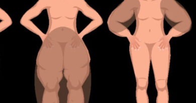 Chef Paula Larenas relata su lucha contra el Lipedema: “Te sientes hinchada y duele al caminar”