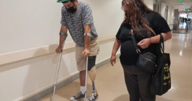 Pacientes reciben prótesis que les permiten volver a caminar de manera más independiente