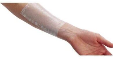 Hospital Dr. Gustavo Fricke SSVQP realiza tratamiento para quemados con tecnología en apósitos biosintéticos.