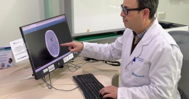 Neurólogo analizando una imagen cerebral en monitor de computador.