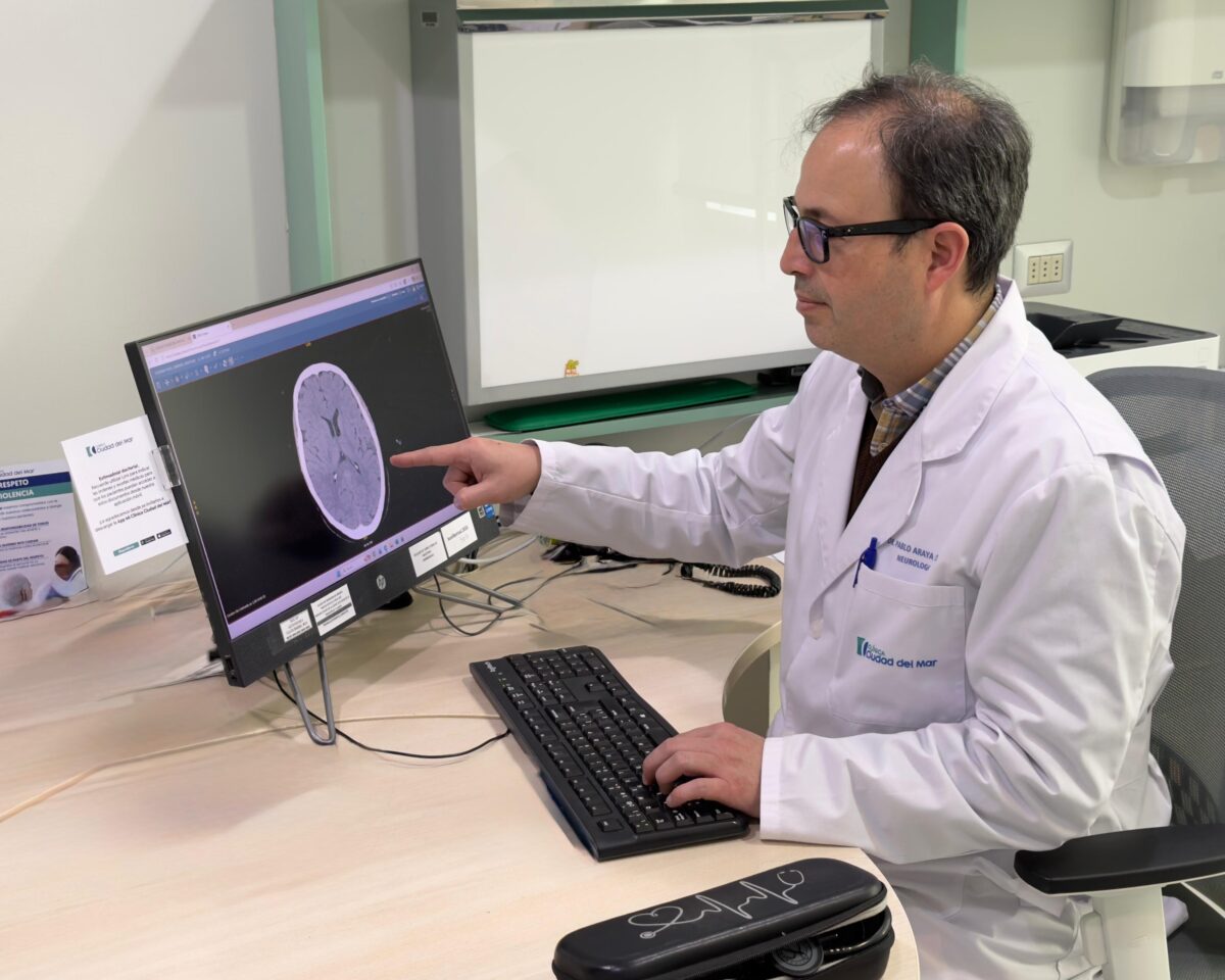 Neurólogo analizando una imagen cerebral en monitor de computador.
